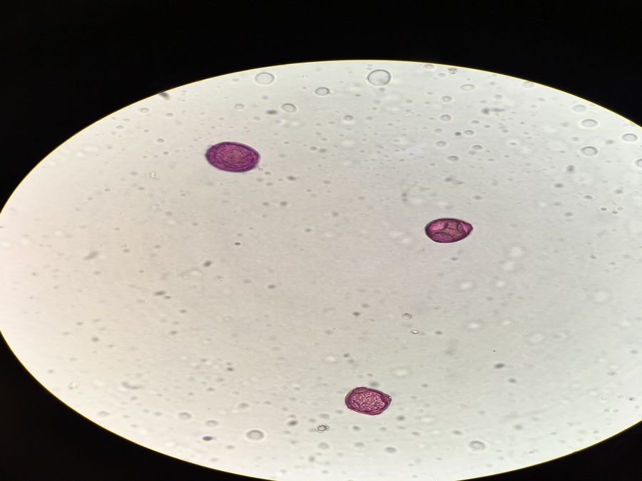 Billede fra mikroskop der viser pollen fra elm, hassel og el